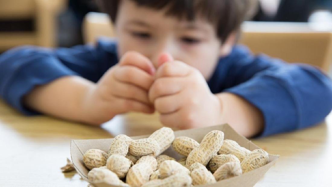 alergi kacang pada anak